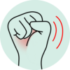 Weakness in grip or pinch